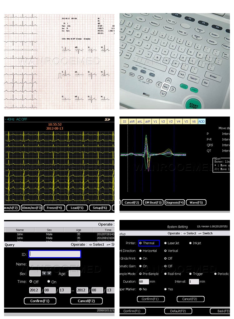 ECG Monitor, ECG, Portable ECG Monitor, Hospital ECG Machine, Handhold ECG Machine