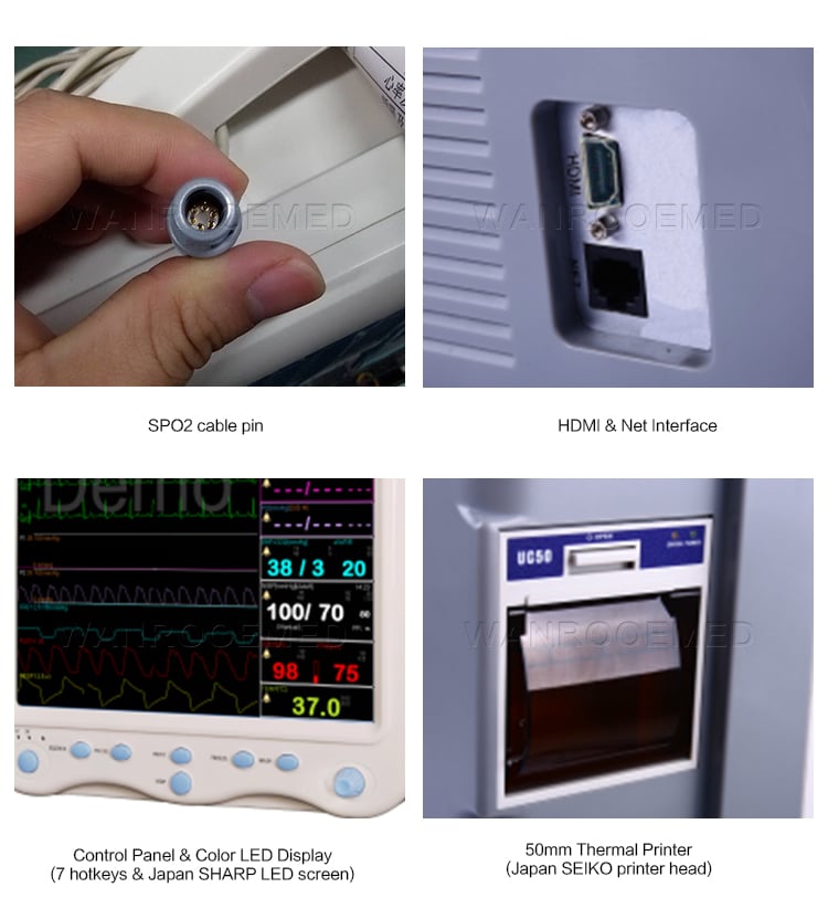Patient Monitor, Multi-Parameter Patient Monitor, Hospital Patient Monitor, Portable Patient Monitor, Emergency Patient Monitor
